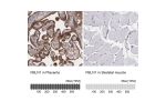 Immunohistochemistry analysis in human placenta and skeletal muscle tissues using HPA001613 antibody. Corresponding FBLN1 RNA-seq data are presented for the same tissues.