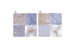 Immunohistochemical staining of human colon, kidney, prostate and testis using Anti-KNG1 antibody HPA001616 (A) shows similar protein distribution across tissues to independent antibody HPA001645 (B).