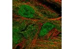 Immunofluorescent staining of human cell line BJ shows localization to nucleoplasm & cytosol.