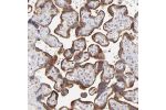 Immunohistochemical staining of human placenta shows strong cytoplasmic positivity in trophoblastic cells.