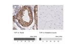 Immunohistochemistry analysis in human testis and skeletal muscle tissues using HPA001636 antibody. Corresponding TJP1 RNA-seq data are presented for the same tissues.