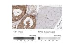 Immunohistochemistry analysis in human testis and skeletal muscle tissues using HPA001637 antibody. Corresponding TJP1 RNA-seq data are presented for the same tissues.
