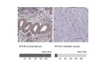 Immunohistochemistry analysis in human endometrium and skeletal muscle tissues using HPA001644 antibody. Corresponding MYH9 RNA-seq data are presented for the same tissues.