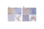 Immunohistochemistry analysis in human kidney and skeletal muscle tissues using HPA001645 antibody. Corresponding KNG1 RNA-seq data are presented for the same tissues.
