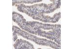 Immunohistochemical staining of human Fallopian tube shows weak cytoplasmic positivity in glandular cells.