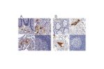 Immunohistochemical staining of human colon, kidney, lung and lymph node using Anti-APOH antibody HPA001654 (A) shows similar protein distribution across tissues to independent antibody HPA003732 (B).