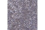 Immunohistochemical staining of human lymph node shows strong nuclear positivity in non-germinal center cells.