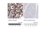 Immunohistochemistry analysis in human placenta and skeletal muscle tissues using HPA001667 antibody. Corresponding PAPPA RNA-seq data are presented for the same tissues.
