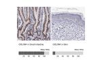 Immunohistochemistry analysis in human small intestine and skin tissues using HPA001677 antibody. Corresponding GOLIM4 RNA-seq data are presented for the same tissues.