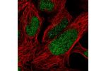Immunofluorescent staining of human cell line HEK 293 shows localization to nucleoplasm.