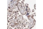 Immunohistochemistry analysis in human placenta and pancreas tissues using Anti-ARNT antibody. Corresponding ARNT RNA-seq data are presented for the same tissues.