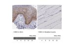 Immunohistochemistry analysis in human skin and skeletal muscle tissues using HPA001767 antibody. Corresponding CDH3 RNA-seq data are presented for the same tissues.