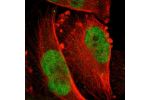 Immunofluorescent staining of human cell line U-251 MG shows localization to nucleoplasm.