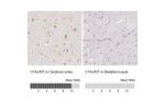 Immunohistochemistry analysis in human cerebral cortex and skeletal muscle tissues using Anti-C14orf37 antibody. Corresponding C14orf37 RNA-seq data are presented for the same tissues.