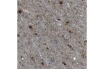 Immunohistochemical staining of human cerebral cortex shows strong cytoplasmic positivity in glial cells.