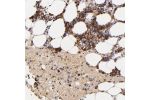 Immunohistochemical staining of human bone marrow shows strong cytoplasmic positivity in bone marrow poietic cells.