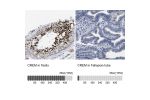 Immunohistochemistry analysis in human testis and cerebral cortex tissues using Anti-CREM antibody. Corresponding CREM RNA-seq data are presented for the same tissues.