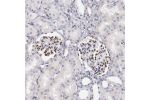 Immunohistochemical staining of human kidney shows strong nuclear positivity in cells in glomeruli.