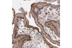 Immunohistochemical staining of human Placenta shows strong cytoplasmic and membranous positivity in trophoblastic cells.
