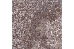 Immunohistochemical staining of human tonsil shows moderate to strong nuclear positivity in non-germinal center cells.