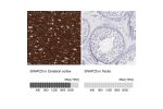 Immunohistochemistry analysis in human cerebral cortex and testis tissues using HPA001830 antibody. Corresponding SNAP25 RNA-seq data are presented for the same tissues.