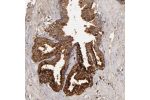 Immunohistochemical staining of human prostate shows strong cytoplasmic positivity in glandular cells.