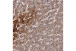 Immunohistochemical staining of human liver shows moderate cytoplasmic positivity in hepatocytes.