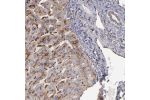 Immunohistochemical staining of human liver shows strong granular cytoplasmic positivity in hepatocytes.