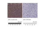Immunohistochemistry analysis in human lymph node and pancreas tissues using HPA001864 antibody. Corresponding VAV1 RNA-seq data are presented for the same tissues.
