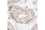 Immunohistochemical staining of human testis shows moderate nuclear positivity in cells in seminiferous ducts.