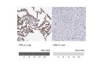 Immunohistochemistry analysis in human lung and liver tissues using HPA001868 antibody. Corresponding PRX RNA-seq data are presented for the same tissues.