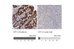 Immunohistochemistry analysis in human duodenum and lymph node tissues using HPA001869 antibody. Corresponding FAT1 RNA-seq data are presented for the same tissues.