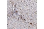 Immunohistochemical staining of human liver shows strong cytoplasmic and membranous positivity in bile duct cells.