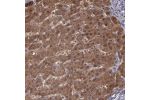 Immunohistochemical staining of human liver shows strong cytoplasmic positivity in hepatocytes.