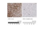 Immunohistochemistry analysis in human liver and cerebral cortex tissues using HPA001888 antibody. Corresponding LRG1 RNA-seq data are presented for the same tissues.