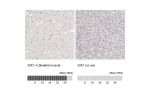 Immunohistochemistry analysis in human skeletal muscle and liver tissues using HPA001893 antibody. Corresponding SIX1 RNA-seq data are presented for the same tissues.