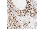 Immunohistochemical staining of human lymph node shows strong nuclear positivity in cells in seminiferous ducts.
