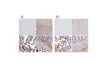 Immunohistochemical staining of human cerebral cortex, liver, placenta and rectum using Anti-FGB antibody HPA001900 (A) shows similar protein distribution across tissues to independent antibody HPA001901 (B).