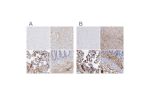 Immunohistochemical staining of human cerebral cortex, liver, placenta and rectum using Anti-FGB antibody HPA001901 (A) shows similar protein distribution across tissues to independent antibody HPA001900 (B).