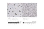 Immunohistochemistry analysis in human cerebral cortex and liver tissues using HPA001906 antibody. Corresponding ATRX RNA-seq data are presented for the same tissues.