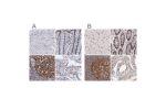Immunohistochemical staining of human cerebral cortex, colon, lymph node and testis using Anti-TERF2 antibody HPA001907 (A) shows similar protein distribution across tissues to independent antibody HPA002735 (B).