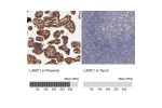 Immunohistochemistry analysis in human placenta and tonsil tissues using HPA001908 antibody. Corresponding LAMC1 RNA-seq data are presented for the same tissues.