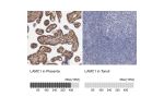 Immunohistochemistry analysis in human placenta and tonsil tissues using HPA001909 antibody. Corresponding LAMC1 RNA-seq data are presented for the same tissues.