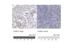 Immunohistochemistry analysis in human testis and tonsil tissues using HPA001923 antibody. Corresponding SOX6 RNA-seq data are presented for the same tissues.