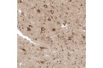 Immunohistochemical staining of human cerebral cortex shows moderate cytoplasmic positivity in neurons.