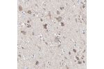 Immunohistochemical staining of human cerebral cortex shows strong cytoplasmic positivity in neuronal cells.