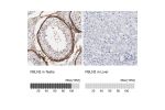 Immunohistochemistry analysis in human testis and liver tissues using HPA001934 antibody. Corresponding FBLN2 RNA-seq data are presented for the same tissues.