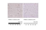 Immunohistochemistry analysis in human cerebral cortex and skeletal muscle tissues using HPA001936 antibody. Corresponding PNMA2 RNA-seq data are presented for the same tissues.