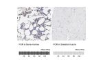 Immunohistochemistry analysis in human bone marrow and skeletal muscle tissues using HPA002024 antibody. Corresponding FGR RNA-seq data are presented for the same tissues.