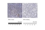 Immunohistochemistry analysis in human tonsil and kidney tissues using HPA002038 antibody. Corresponding IRF4 RNA-seq data are presented for the same tissues.